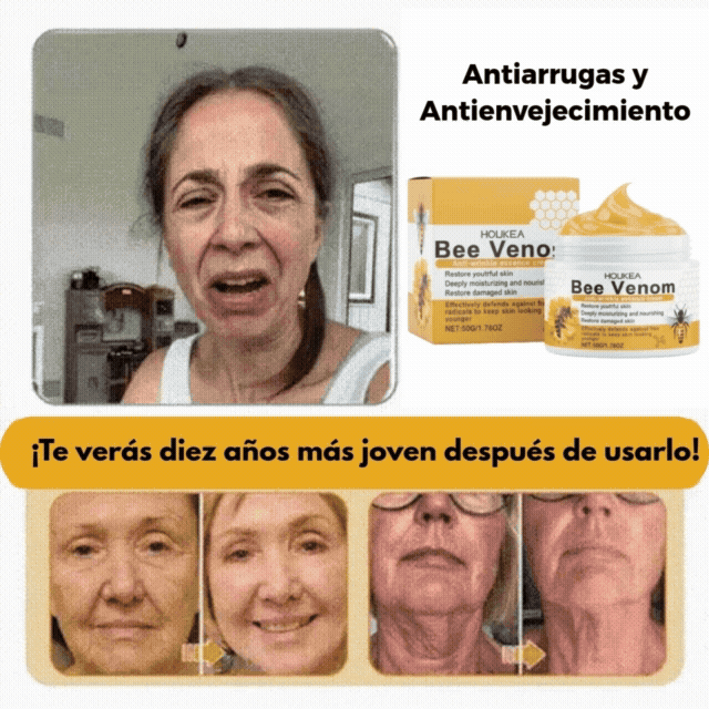 Crema Hoijkea™ | El descubrimiento natural "prohibido" que borra años de daño cutáneo y pone fin a la batalla diaria contra la psoriasis, las arrugas y las afecciones cutáneas crónicas
